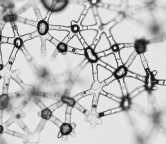 Aquaporins and their Importance to Water and to Life