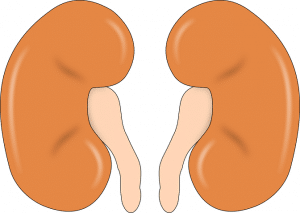 Tips on How to Prevent Kidney Stones