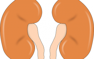 Tips on How to Prevent Kidney Stones