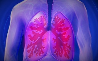 The Severity of Pulmonary Edema